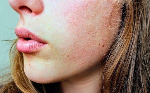 Peau sèche et peau déshydratée : quelle différence ? - The Eco Shop