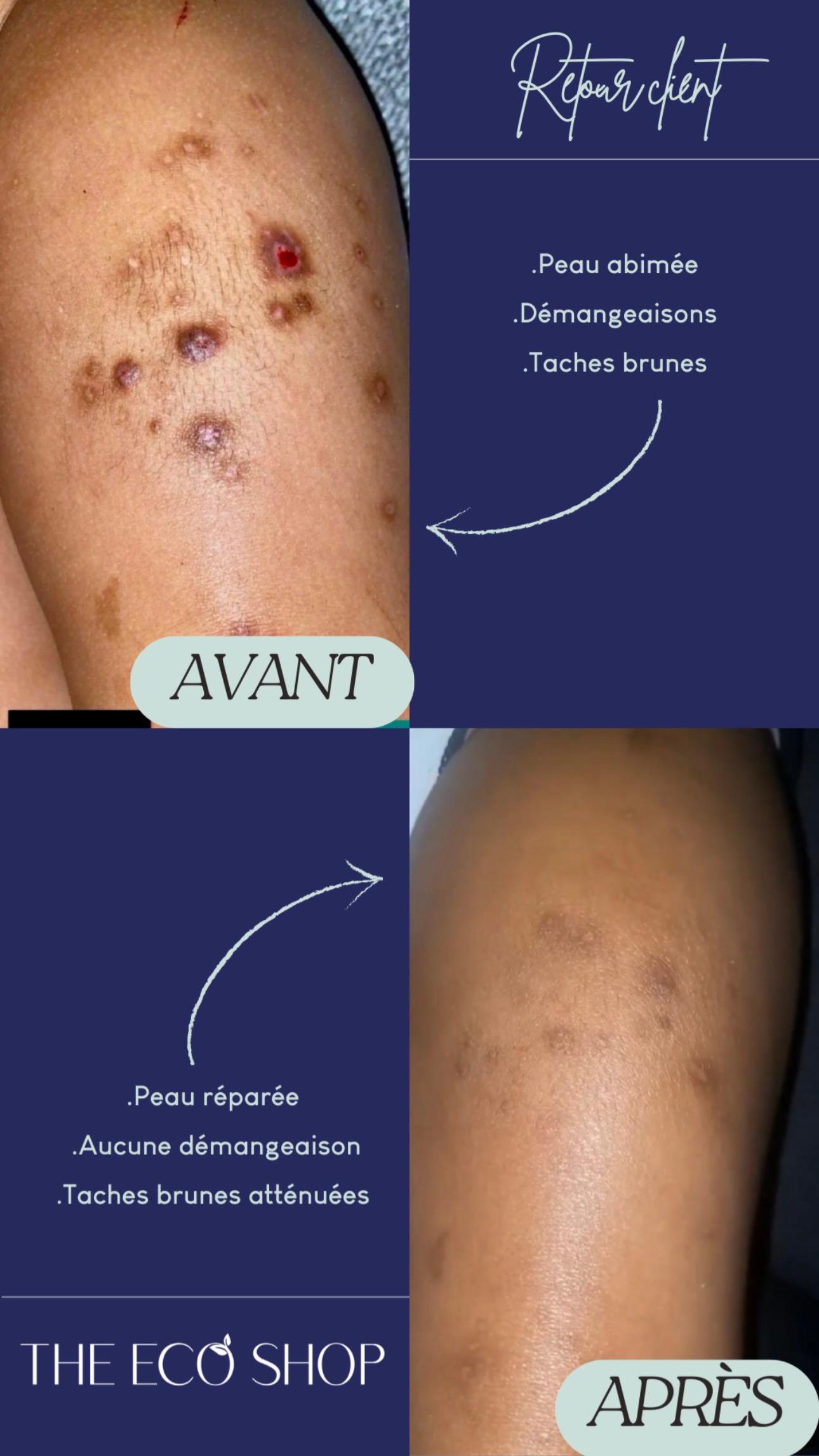 <p>Avant / Après</p>