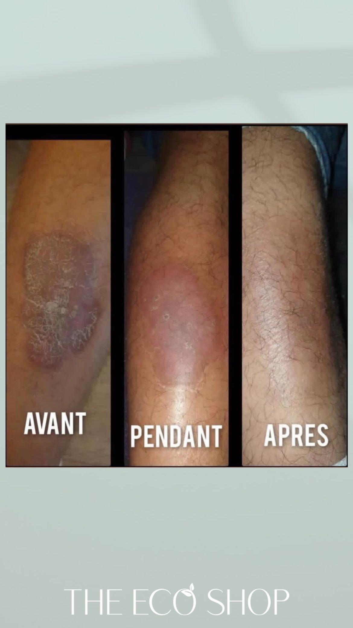 <p>Avant / Après</p>