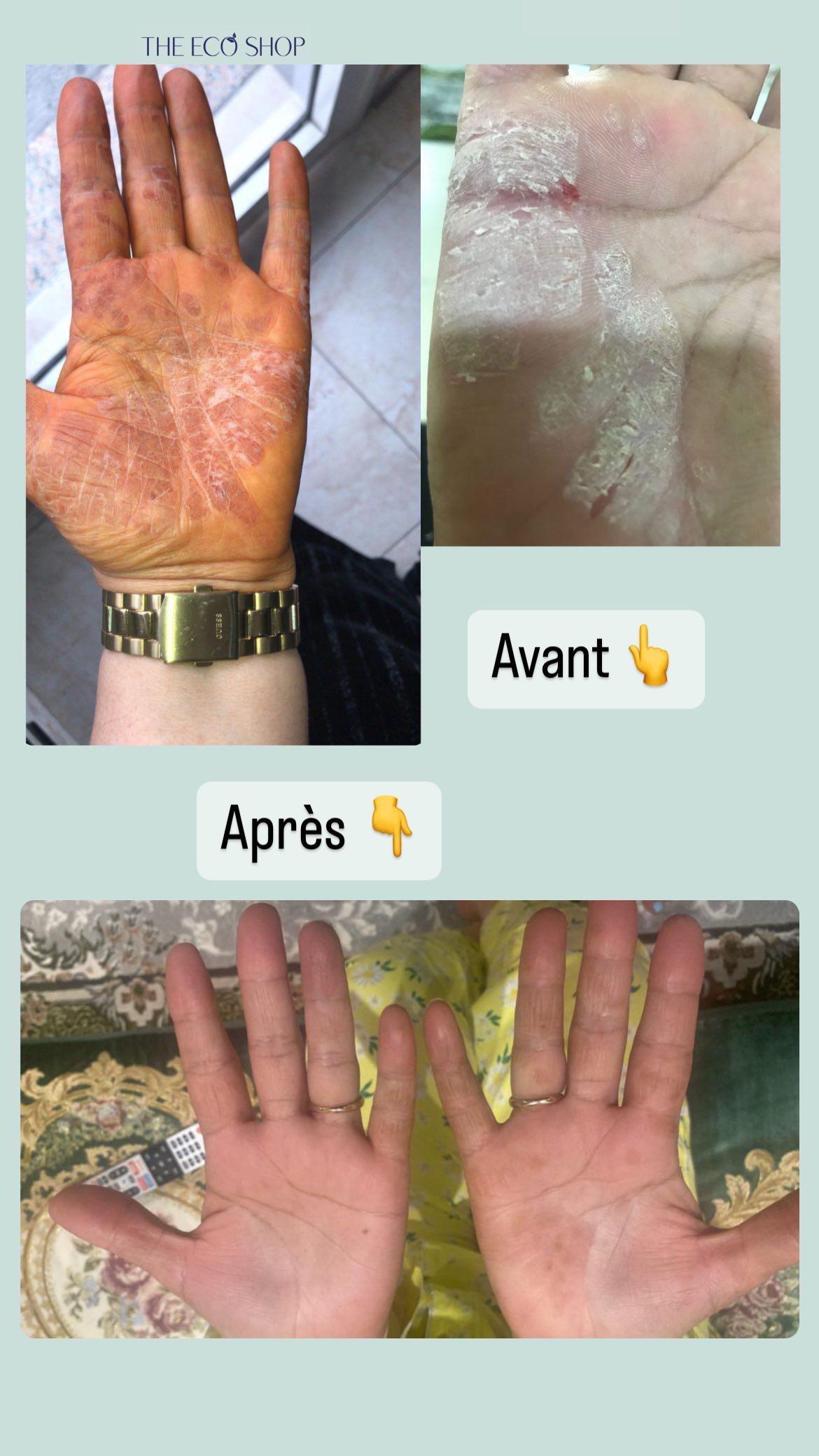 <p>Avant / Après</p>