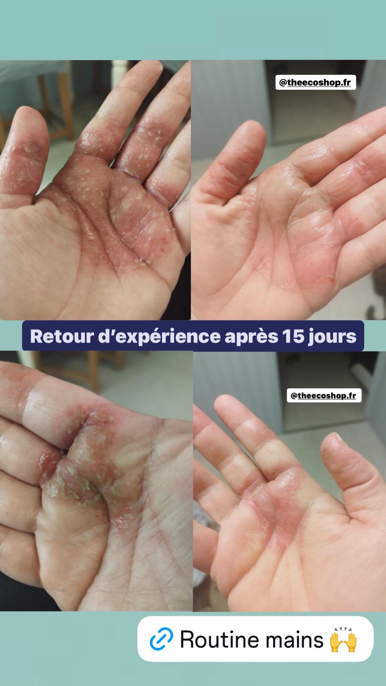 <p>Avant / Après</p>