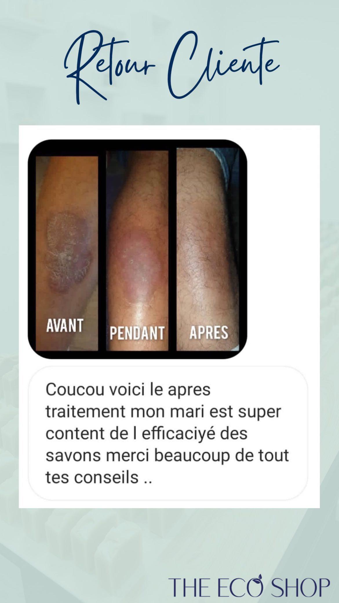 <p>Avant / Après</p>