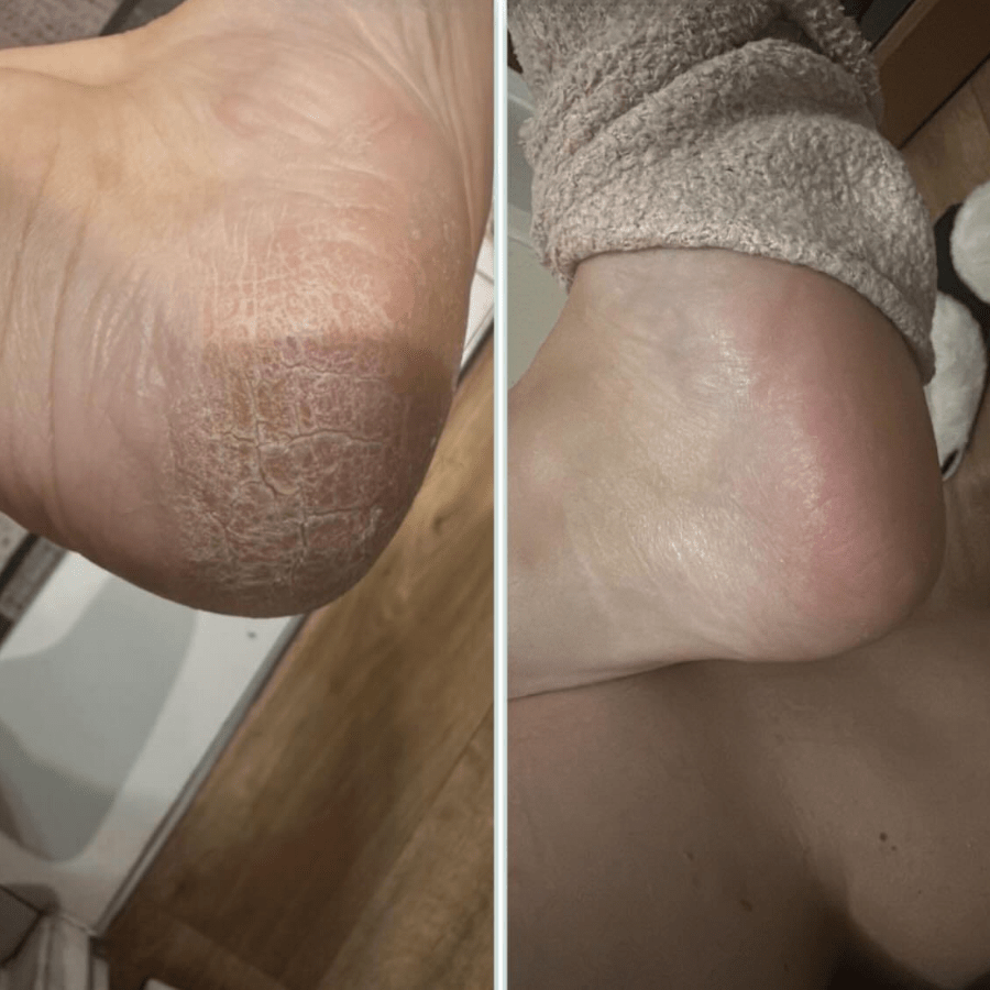 Routine pieds de bébé - The Eco Shop