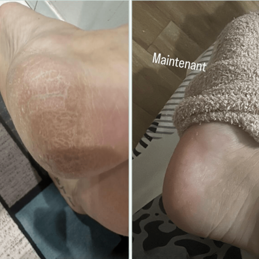 Routine pieds de bébé - The Eco Shop